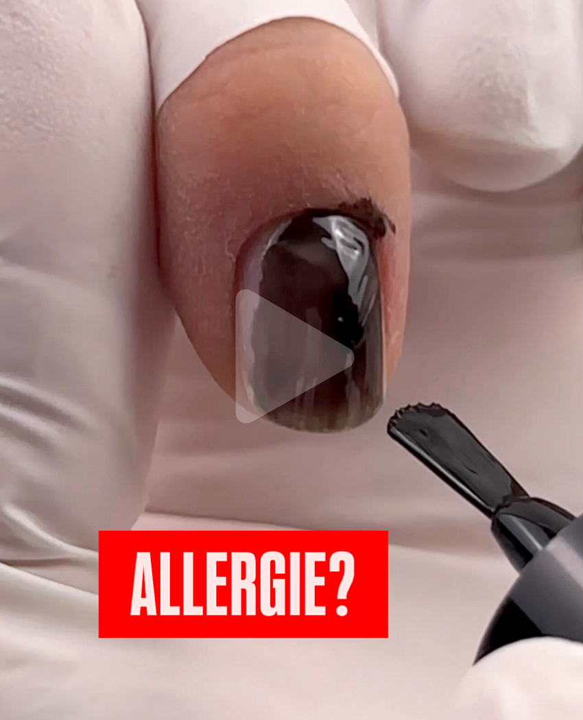 Kontaktallergie UV-Nagellack